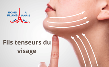 Fils tenseurs visage à Paris fil tenseur visage paris